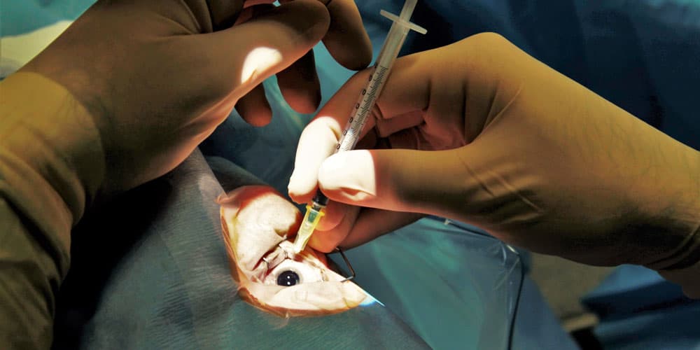 Injection intravitréenne